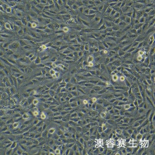 HCMEC/D3永生化脑微血管内皮细胞