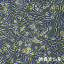 GIST-T1 人胃肠道间质瘤细胞