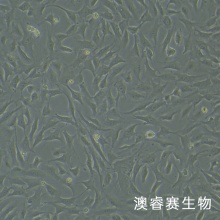 hRMECs（人视网膜微血管内皮细胞）