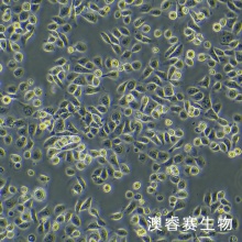 HEEC 人正常食管上皮细胞