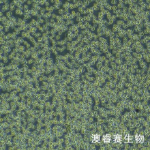 OCI-LY19细胞；人弥漫大B淋巴瘤细胞