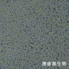 OCI-LY19细胞；人弥漫大B淋巴瘤细胞