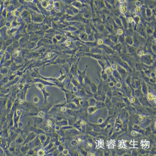 12Z细胞;人源子宫内膜异位细胞