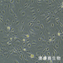 HLEC细胞;人晶状体上皮细胞
