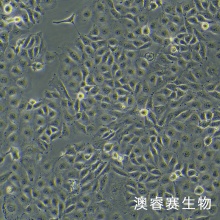 ECV304 血管内皮细胞
