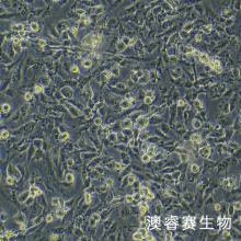 MUM2B 人侵袭性脉络膜黑色素瘤细胞