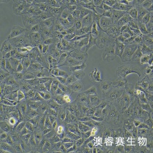 OAW42 卵巢癌细胞