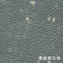 OAW42 卵巢癌细胞