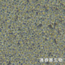 OCI-LY10（人弥漫大B淋巴瘤细胞）