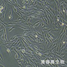 U251MG/TMZ 人类星形胶质瘤耐替莫唑胺细胞