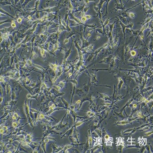 U87MG-Luc（人脑星形胶质母细胞瘤-荧光素酶标记）