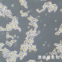WERI-Rb-1-LUC-EGFP 人视网膜神经胶质瘤细胞-绿色荧光蛋白-荧光素酶标记