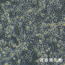 PIG1（正常人皮肤黑色素细胞）