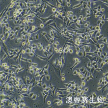 PIG1（正常人皮肤黑色素细胞）