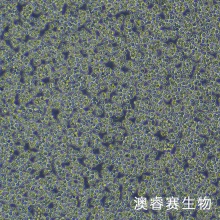 A20（小鼠B细胞淋巴瘤细胞）