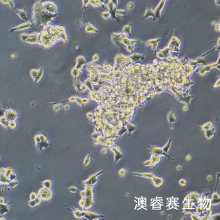 F11（大鼠背根神经节细胞）