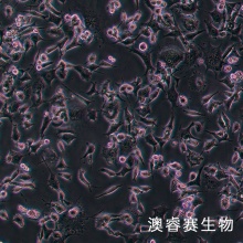 VSC4.1 大鼠脊髓前角运动神经元瘤