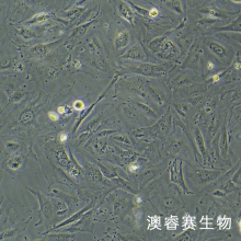 HUH-28人胆管癌细胞