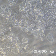 HCC1569 乳腺癌细胞