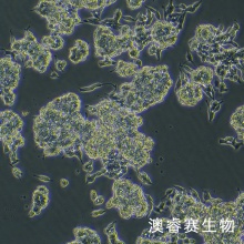 CAL-148 人乳腺癌细胞