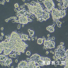 CAL-148 人乳腺癌细胞