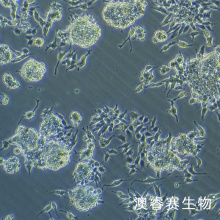 CAL-148 人乳腺癌细胞