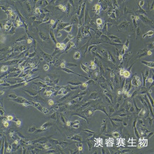 SVGP12 人星形胶质细胞