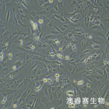 SVGP12 人星形胶质细胞