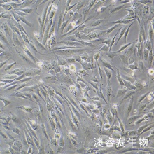 人风湿性关节滑膜成纤维细胞永生化