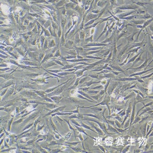 人风湿性关节滑膜成纤维细胞永生化