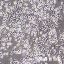 E0771-luc 小鼠髓样乳腺癌细胞-荧光素酶标记