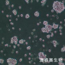 SUP-T1人T淋巴瘤细胞