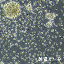 GM12878人B淋巴细胞