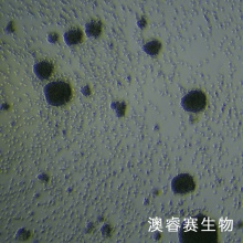 GM12878人B淋巴细胞