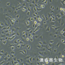 TOV21G人卵巢癌细胞