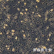 TOV21G人卵巢癌细胞