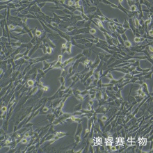 SK-LMS-1人阴户平滑肌肉瘤复苏细胞