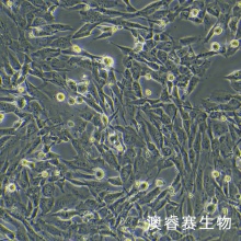 SK-LMS-1人阴户平滑肌肉瘤复苏细胞