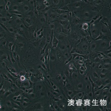 人主动脉内皮细胞永生化
