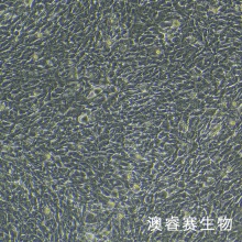 人Ⅱ型肺泡上皮细胞永生化