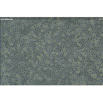 NCTC clone 929 [L cell, L-929]（小鼠成纤维细胞）