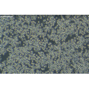 RIN-M5F细胞；大鼠&amp;beta;胰岛素瘤细胞