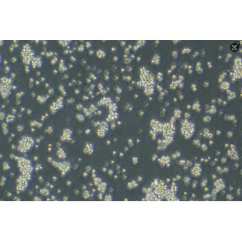 TMD8细胞;人弥漫大B淋巴瘤