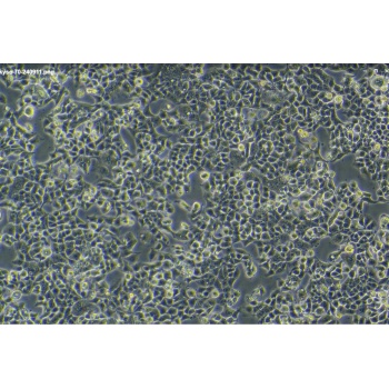 KYSE-70 人食管鳞癌细胞