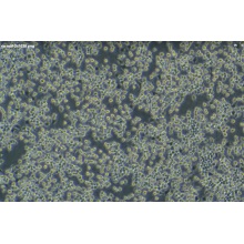 RIN-M5F细胞；大鼠&amp;beta;胰岛素瘤细胞