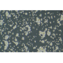 TMD8细胞;人弥漫大B淋巴瘤