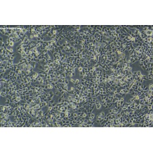 KYSE-70 人食管鳞癌细胞