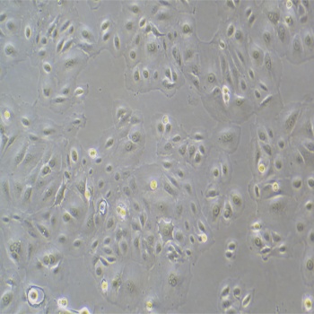 人附睾管上皮细胞