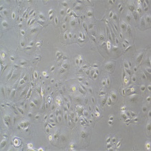 人附睾管上皮细胞