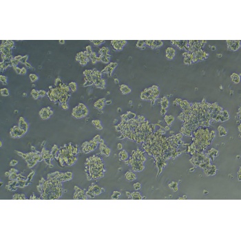 MDA-PCA-2B人前列腺癌细胞